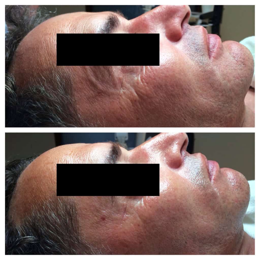 Vorher-Nachher-Bild-01