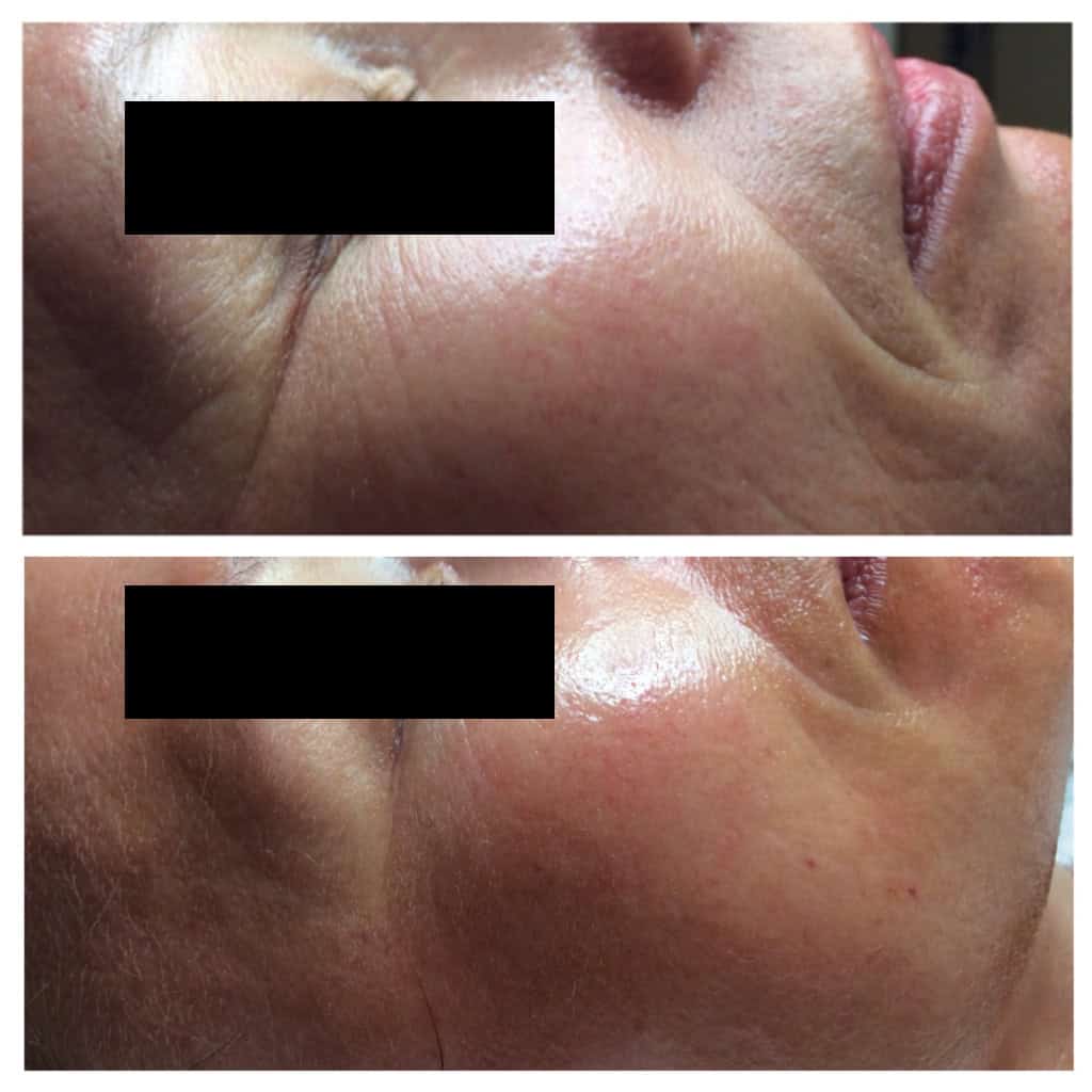 Vorher-Nachher-Bild-04