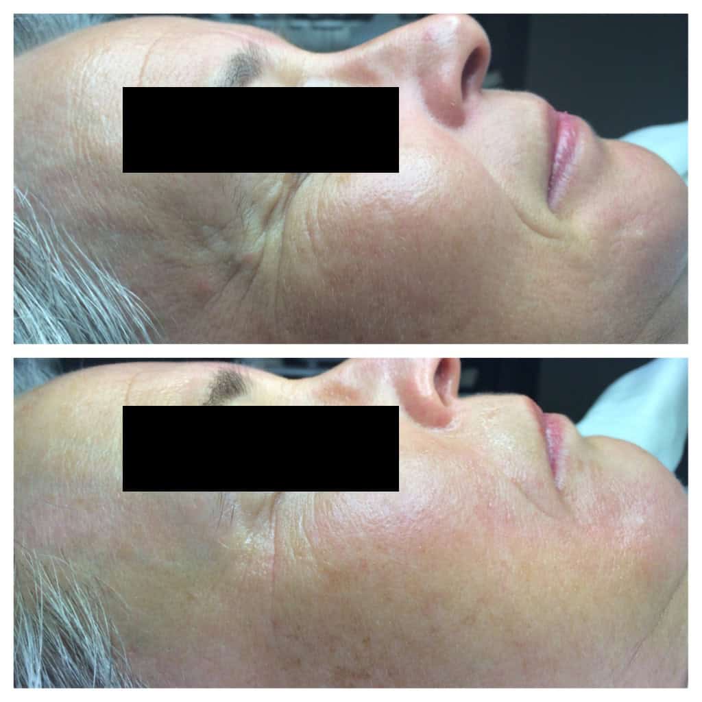 Vorher-Nachher-Bild-09