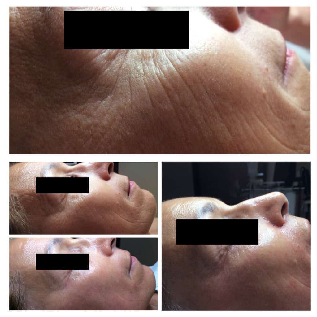 Vorher-Nachher-Bild-06